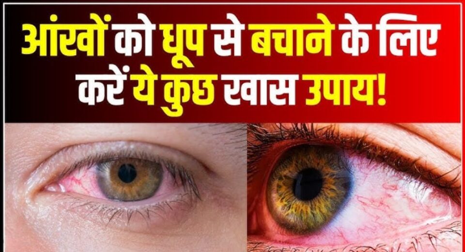 Eye Care in Summer – गर्मियों में आंखों की सुरक्षा का आसान तरीका