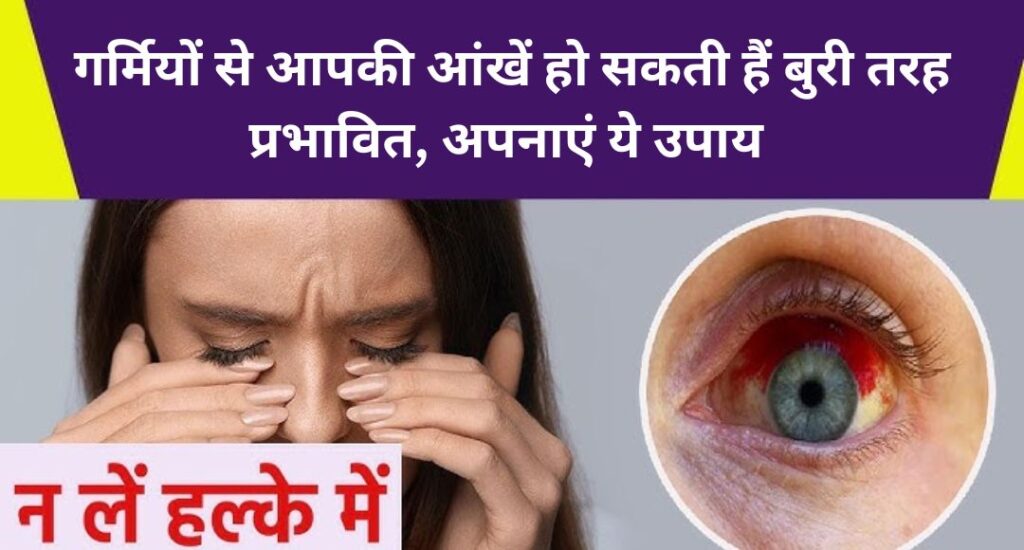 Eye Care in Summer