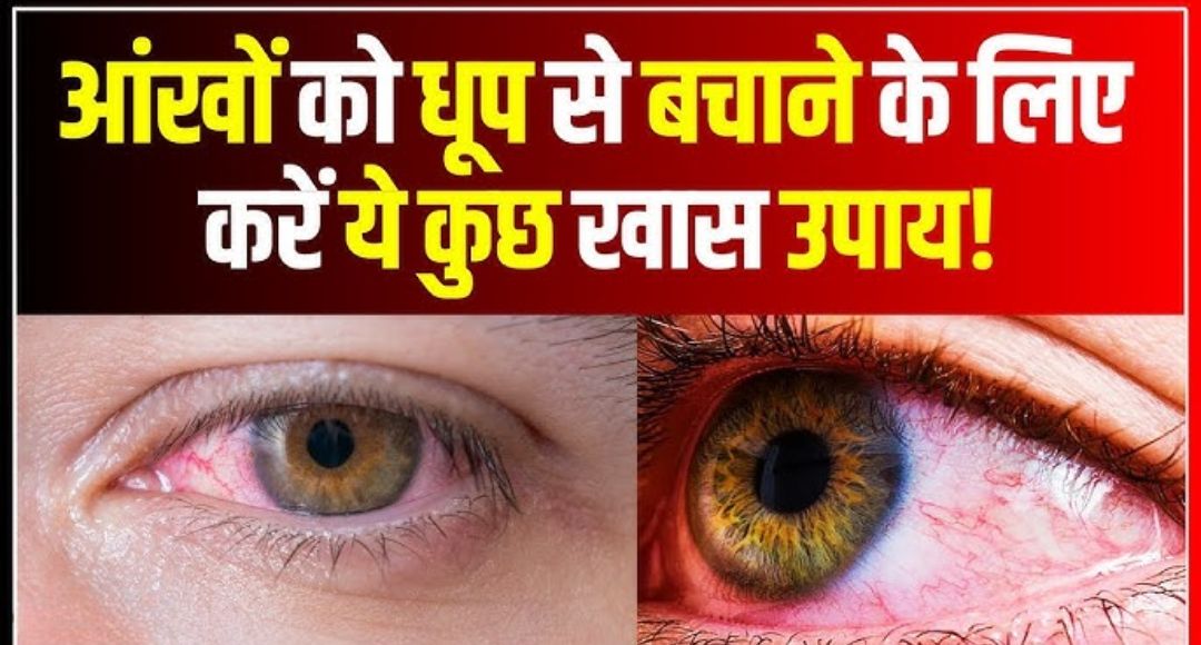 Eye Care in Summer – गर्मियों में आंखों की सुरक्षा का आसान तरीका